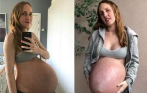 Tânăra care a şocat lumea cu burta de gravidă a născut tripleţi! Primele imagini