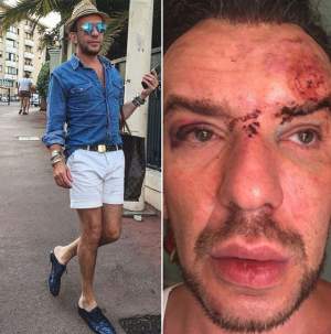 VIDEO / Stephan Pelger nu şi-a revenit complet după trauma suferită la Cannes. Alte probleme l-au dat peste cap
