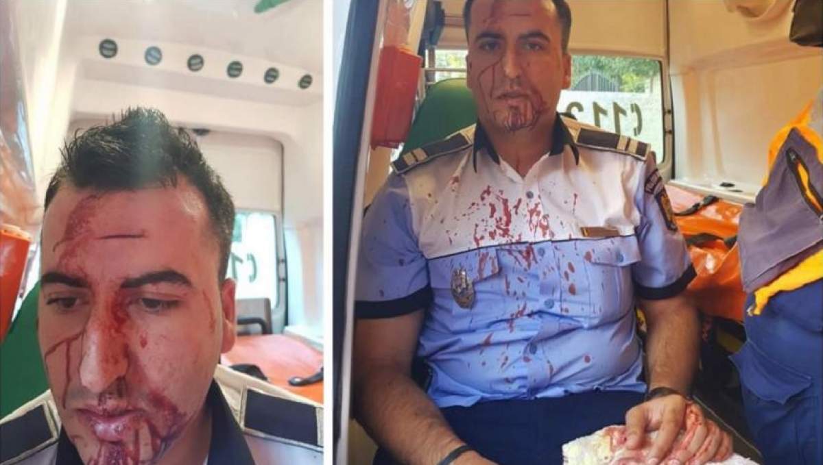 FOTO / Un polițist din Craiova a fost băgat în spital de un șofer