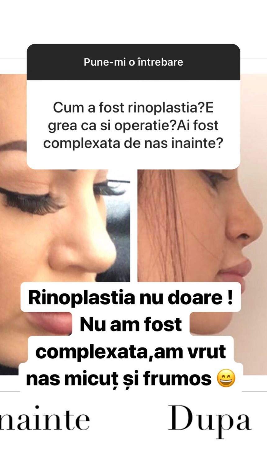 FOTO / De la puștoaică la bombă sexy tunată! Așa arăta Bianca de la „Insula iubirii”, înainte de diverse operații