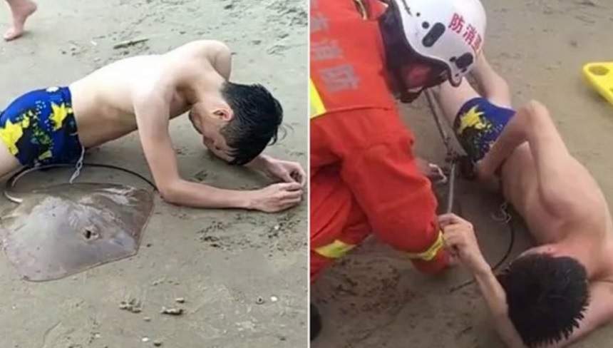 Imagini șocante! Un bărbat se zvârcolește în agonie, după ce a fost înțepat în penis de o pisică de mare