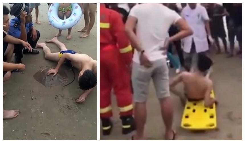 Imagini șocante! Un bărbat se zvârcolește în agonie, după ce a fost înțepat în penis de o pisică de mare