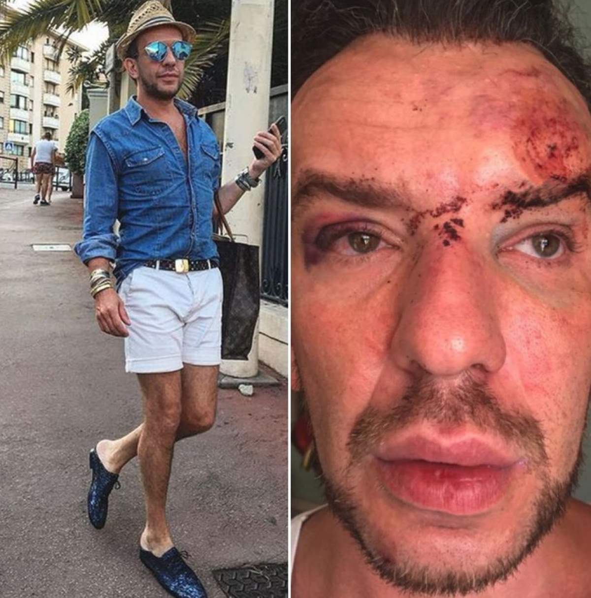VIDEO / Detalii bombă! Ce au hotărât judecătorii, după ce Stephan Pelger a fost bătut crunt la Cannes