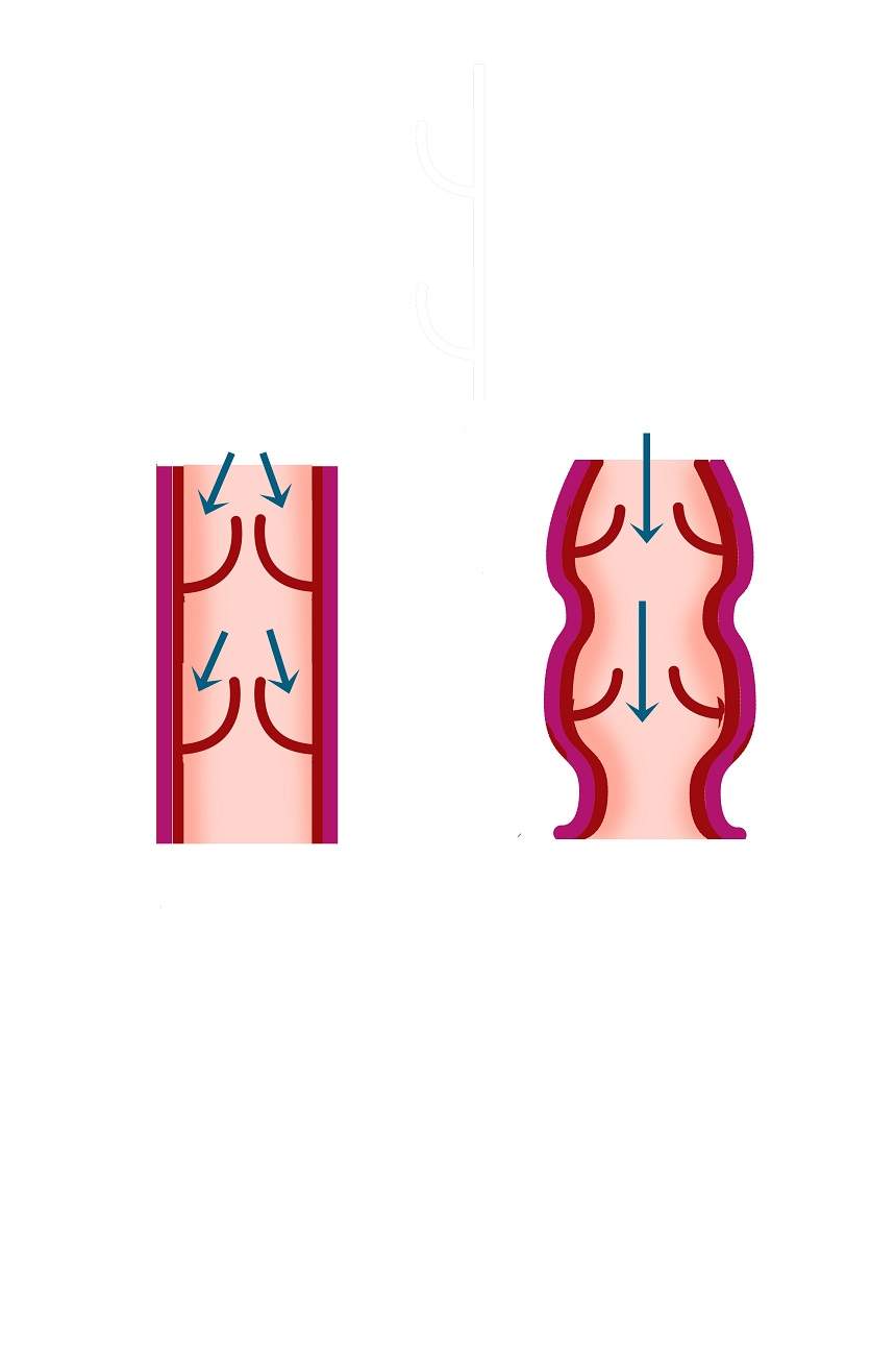 Cum să scapi de varice? Iată câteva remedii naturiste la îndemâna oricui