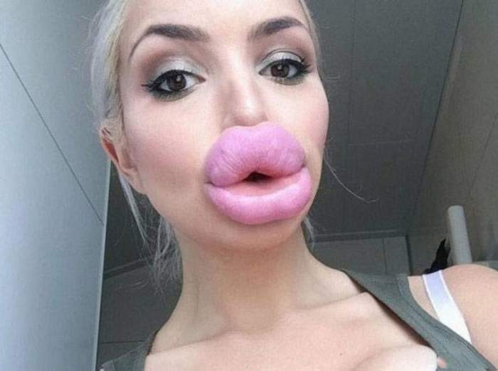 FOTO / Imagini de-a dreptul exagerate! Vezi cât şi-au mărit buzele bloggeriţele pe Instagram