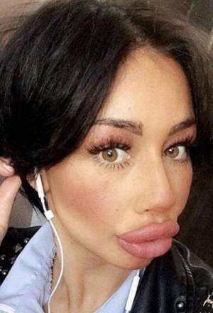 FOTO / Imagini de-a dreptul exagerate! Vezi cât şi-au mărit buzele bloggeriţele pe Instagram