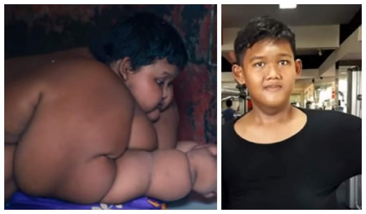 Transformare spectaculoasă! Cum arată acum „cel mai gras copil din lume” / GALERIE FOTO