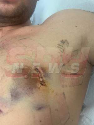 18+ / Imagini cutremurătoare cu victima fiului lui Sile Cămătaru! Declaraţii exclusive