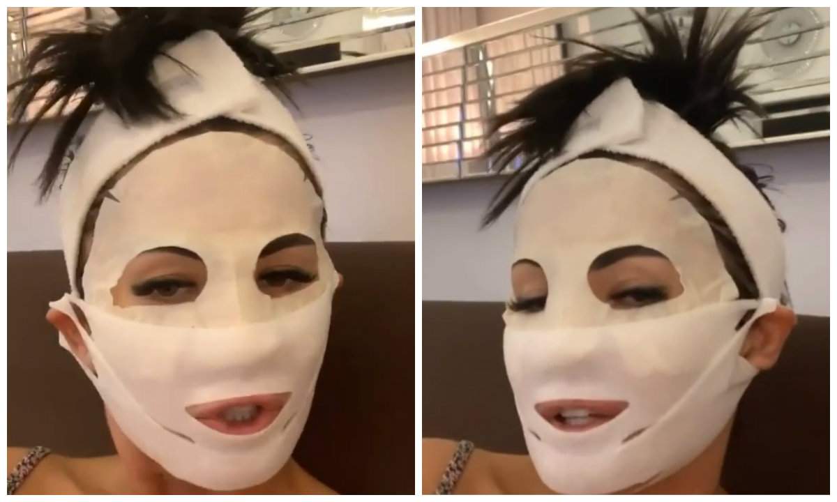Oana Zăvoranu și-a „bandajat” toată fața. Ce le-a transmis fanilor șocați. VIDEO