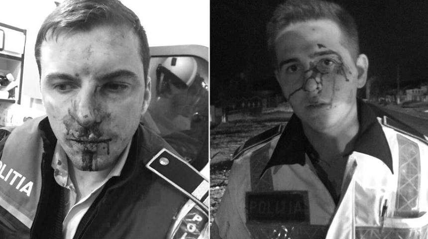 Situație gravă în cazul unuia dintre polițiștii bătuți în Vâlcea! Are nevoie de o intervenție chirurgicală, la București