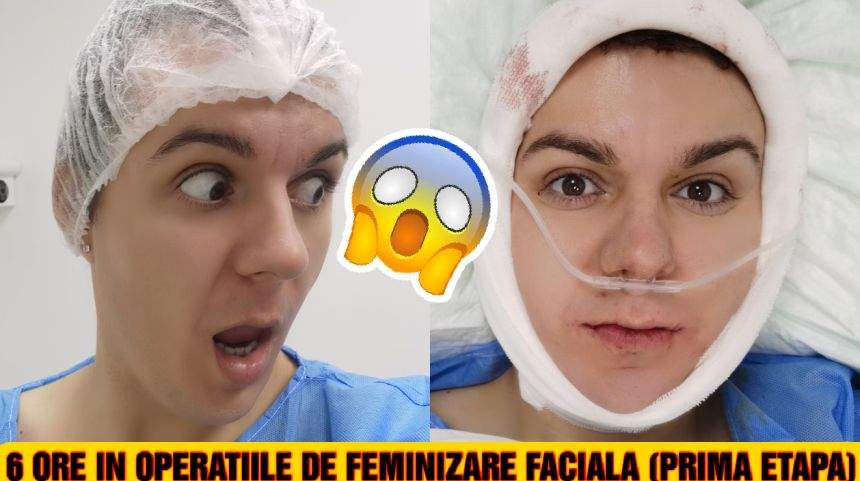 Exclusiv / Keky, artistul pe tocuri, a suferit prima operaţie de feminizare facială. Cum a decurs intervenţia care îl va transforma în femeie