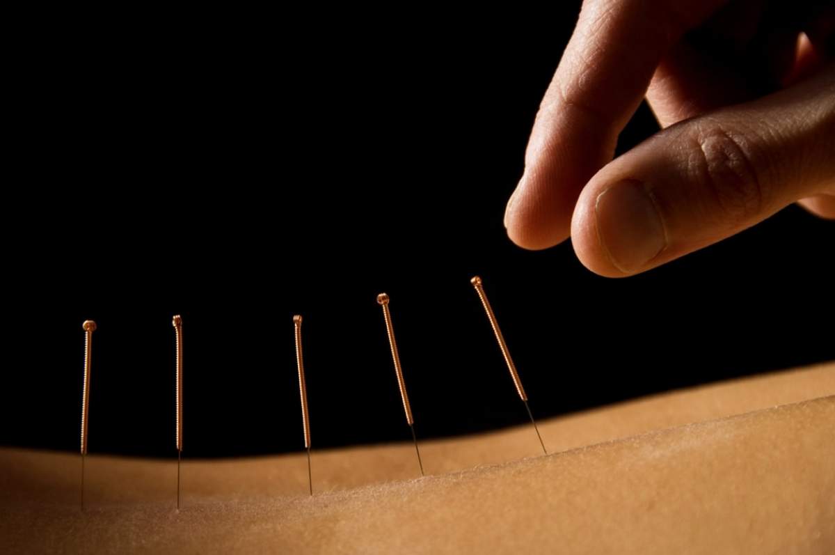 Totul despre acupunctura si de ce sa alegeti serviciile oferite de Clinica specializata acupuncturabucuresti.ro