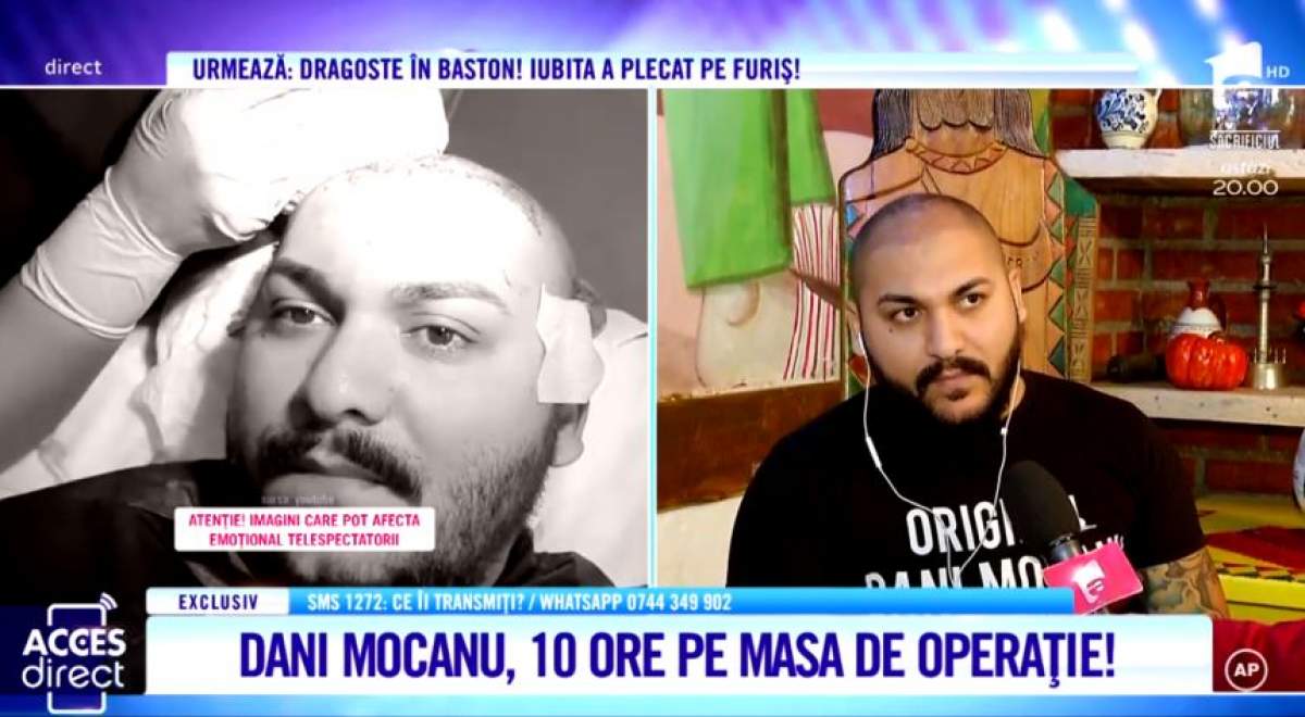 Dani Mocanu, operat timp de zece ore. "M-am speriat, a fost grea intervenţia"