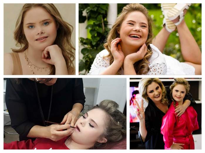Foto Imagini Emoţionante Ale Unui Model Din Brazilia Sindromul Down Nu A Impiedicat O Să Semneze