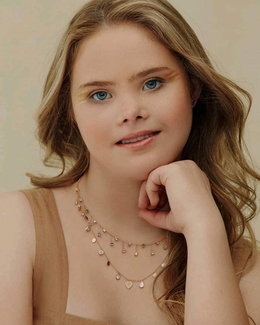 Foto Imagini Emoţionante Ale Unui Model Din Brazilia Sindromul Down Nu A Impiedicat O Să Semneze Contracte Importante De Modeling Galerie Foto Imagine 7 Spynews Ro