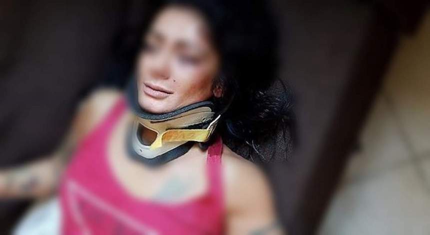 FOTO / Româncă bătută cu bestialitate în Italia! Alexandra este dansatoare şi a fost lovită fără milă de mai mulţi bărbaţi