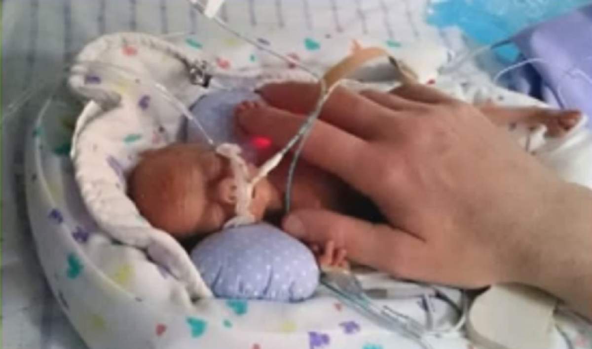 Îl mai știi pe cel mai mic bebeluș din lume, care cântărea doar 270 de grame? Cum arată acum, la șase luni