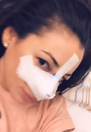 Primele imagini cu Roxana Vancea, după ce şi-a operat nasul / VIDEO