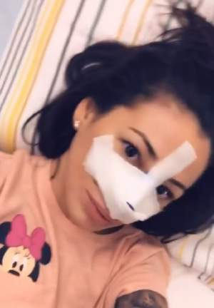 Primele imagini cu Roxana Vancea, după ce şi-a operat nasul / VIDEO