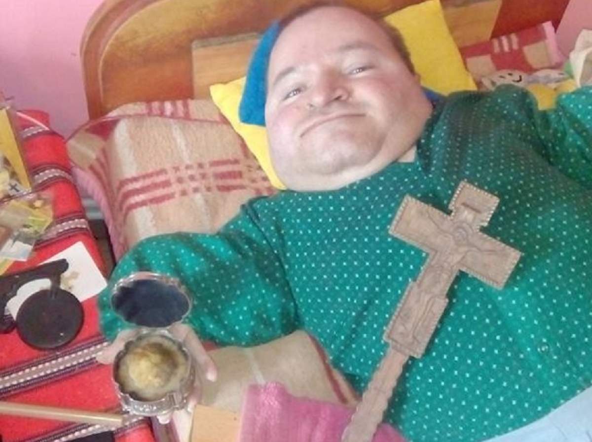 A murit Sorin Focuță, cel mai în vârstă român cu boala oaselor de sticlă