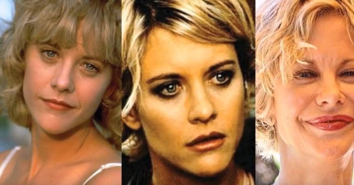 Acestea sunt vedetele desfigurate de botox! Nu au știut să spună „stop” operațiilor estetice