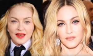Imaginile pe care Madonna le-ar vrea șterse! Cum arăta „regina muzicii pop”, înainte de intervențiile estetice