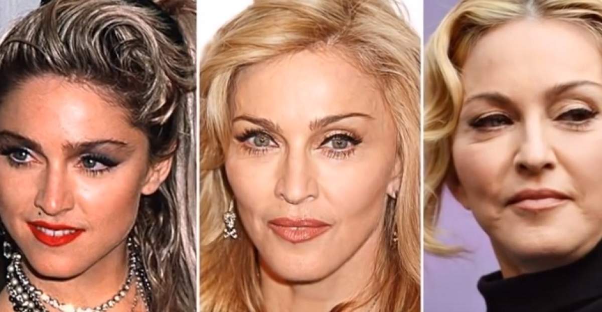 Imaginile pe care Madonna le-ar vrea șterse! Cum arăta „regina muzicii pop”, înainte de intervențiile estetice