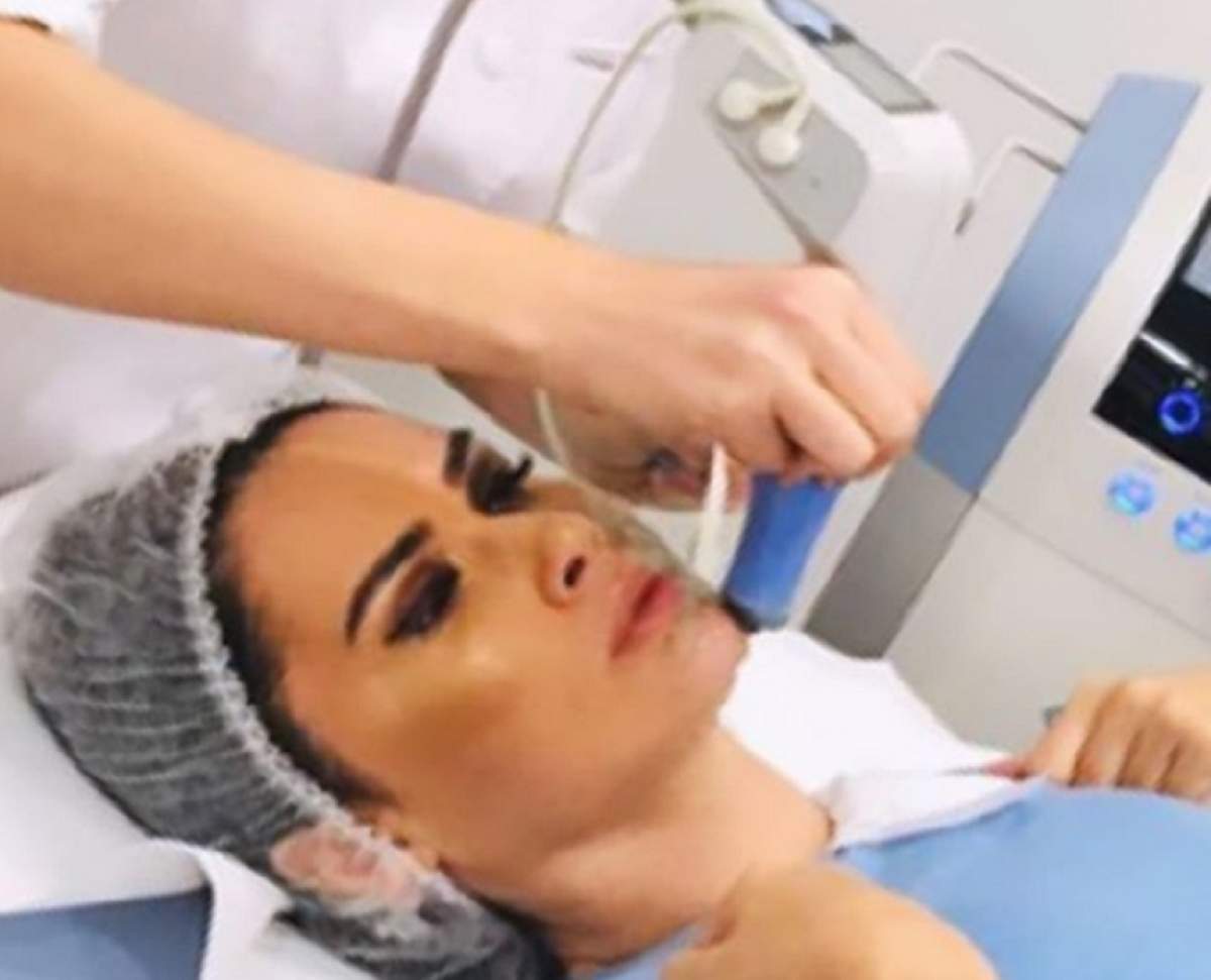 Oana Zăvoranu, vizită la medicul estetician. La ce procedură a apelat bruneta