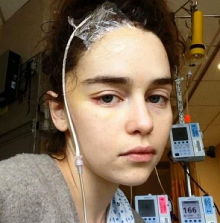 Șoc pentru fanii serialului "Game of Thrones"! Emilia Clarke a suferit un anevrism cerebral