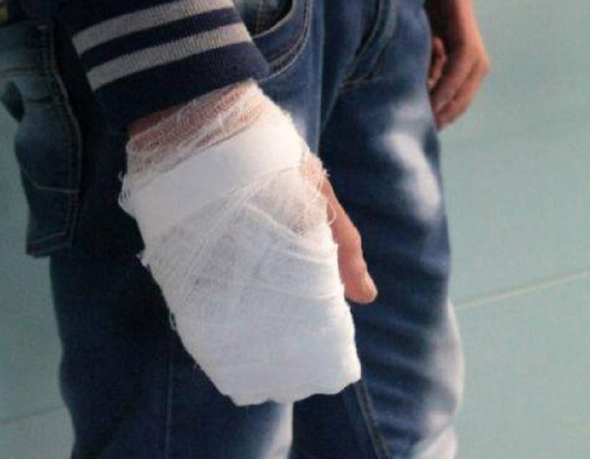 Un tânăr din Vaslui și-a tăiat degetele cu flexul. A ajuns de urgență la spital