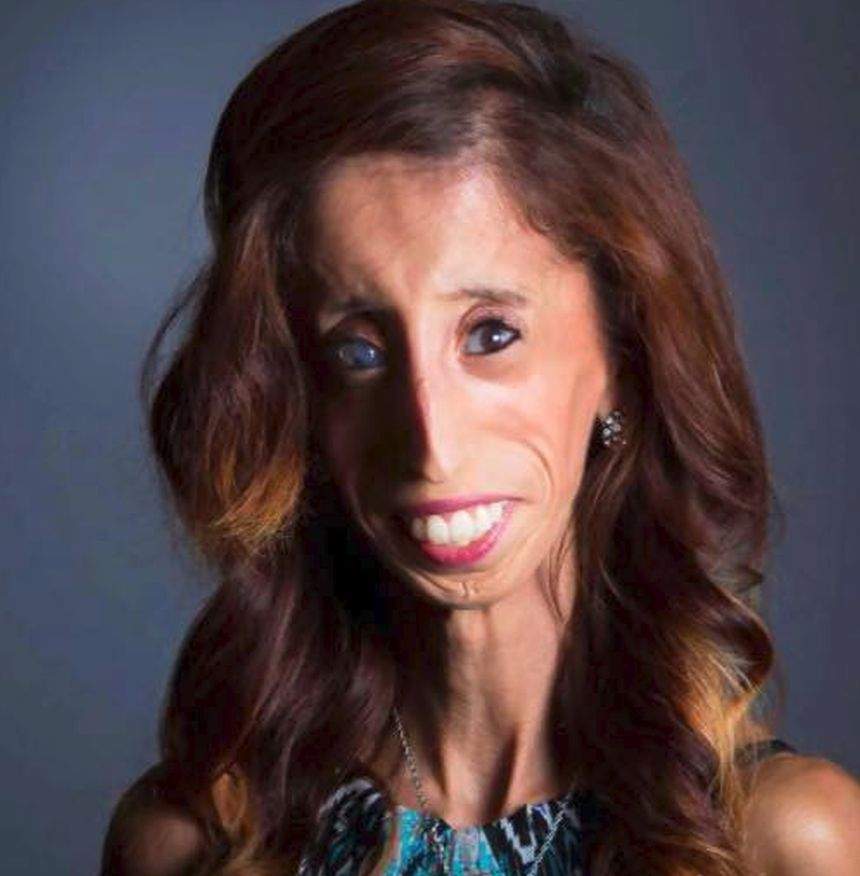 Cum arată în prezent Lizzie Velasquez, considerată cea mai urâtă femeie din lume