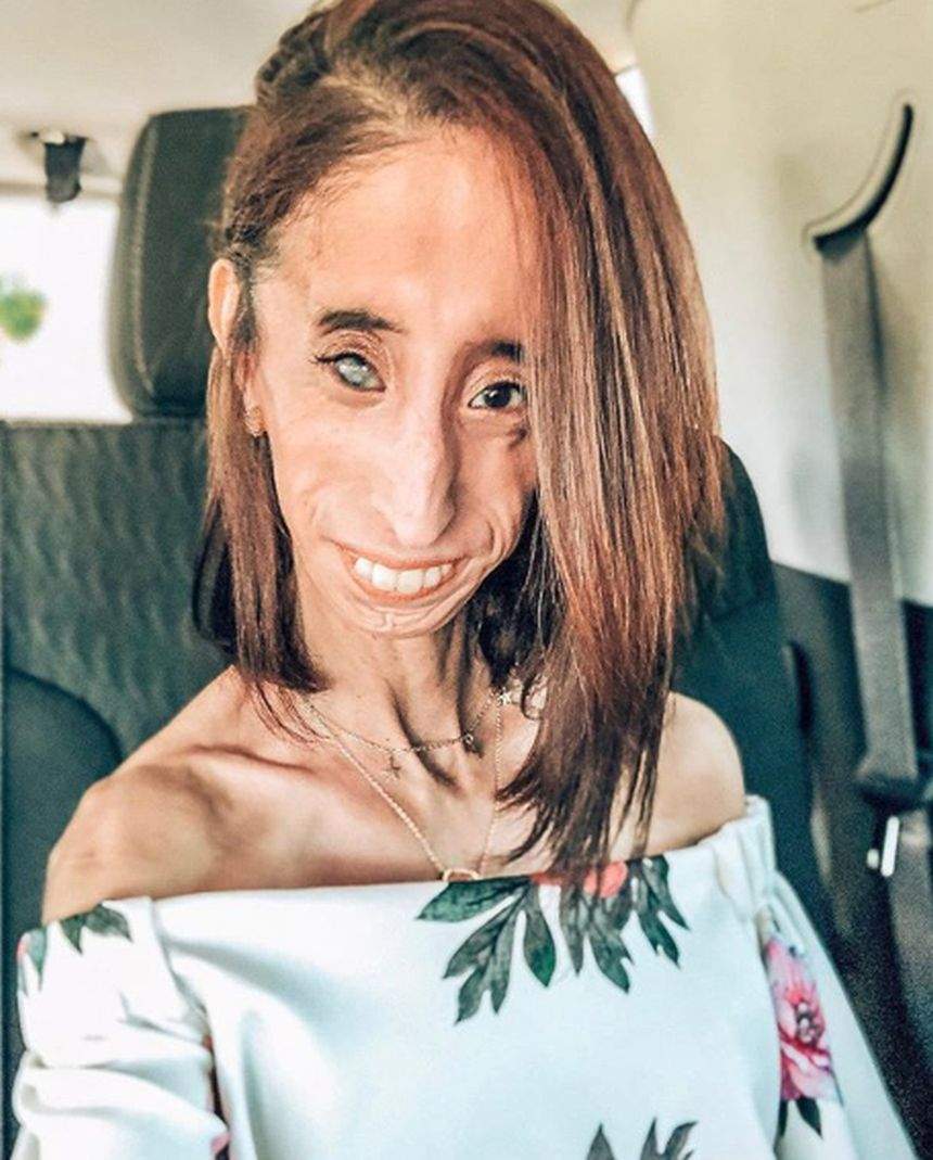 Cum arată în prezent Lizzie Velasquez, considerată cea mai urâtă femeie din lume