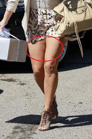 Este idolul tuturor adolescentelor, dar fără Photoshop e de nerecunoscut! Kim Kardashian, cu picioarele invadate de celulită