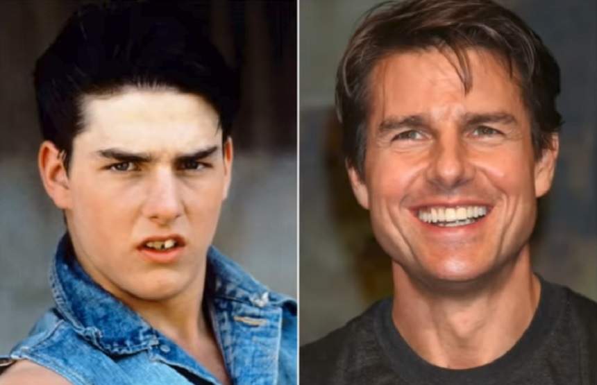 Este considerat unul dintre cei mai frumoși actori, dar în trecut avea o dantură deplorabilă! Cum arăta Tom Cruise, înainte de a deveni celebru