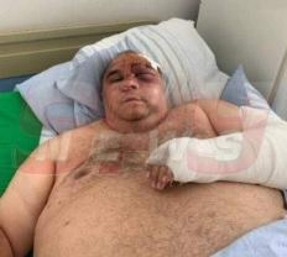 Ion Boschet, bătut cu bestialitate. Interlopul a ajuns la spital