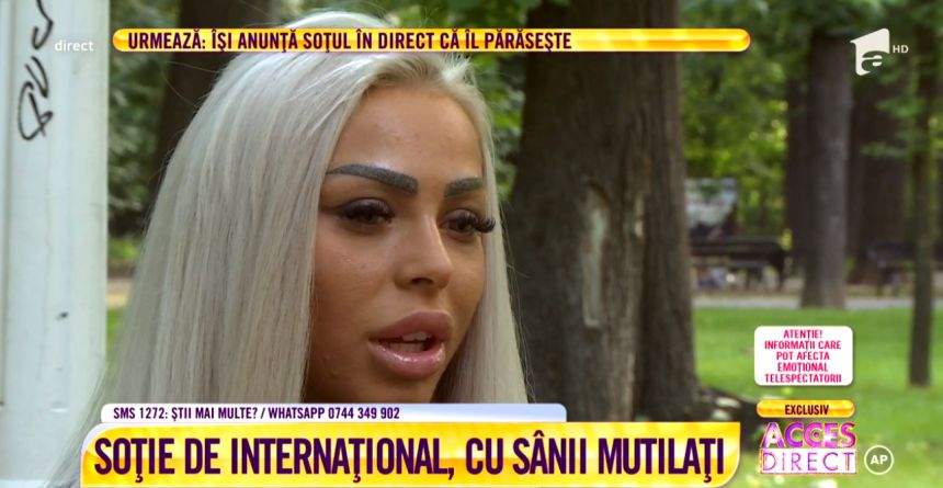 Fostă soţie de fotbalist, cu sânii mutilaţi. Vedetă acuză că a fost operată de un medic stomatolog / VIDEO