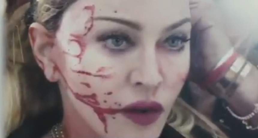 Fanii Madonnei, în stare de șoc! Artista a apărut plină de sânge. FOTO