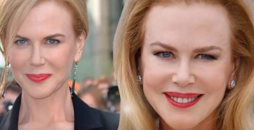 A încercat să-și recâștige tinerețea prin bisturiu, dar arată șocant! Nicole Kidman a cam exagerat cu operațiile estetice