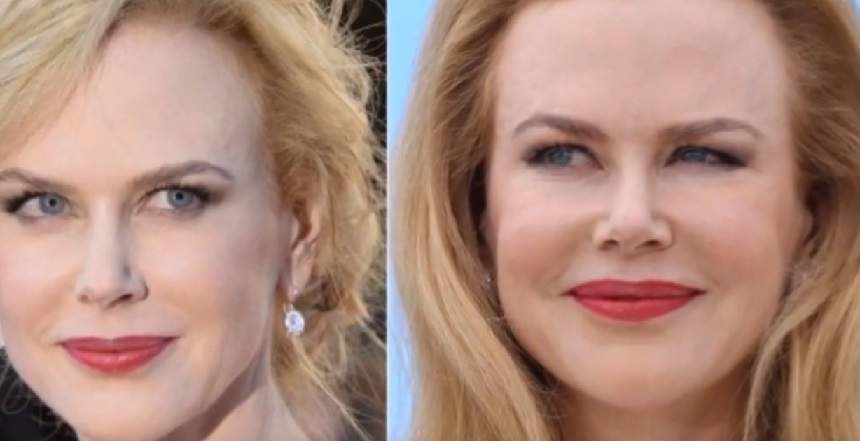 A încercat să-și recâștige tinerețea prin bisturiu, dar arată șocant! Nicole Kidman a cam exagerat cu operațiile estetice