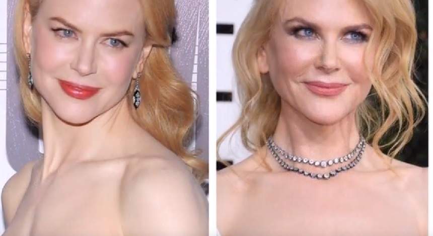 A încercat să-și recâștige tinerețea prin bisturiu, dar arată șocant! Nicole Kidman a cam exagerat cu operațiile estetice