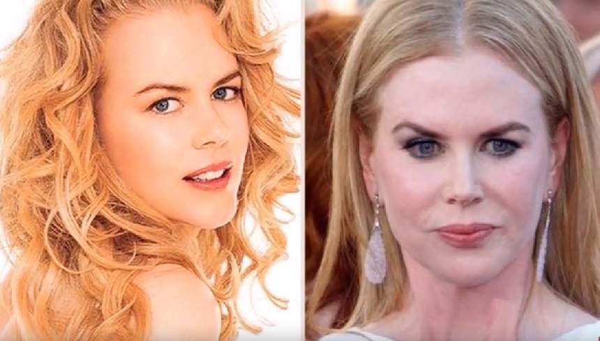 A încercat să-și recâștige tinerețea prin bisturiu, dar arată șocant! Nicole Kidman a cam exagerat cu operațiile estetice