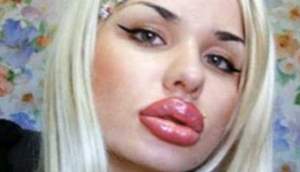 Așa arată femeia cu cele mai mari buze din lume! La 29 de ani, a ajuns desfigurată din cauza operațiilor estetice