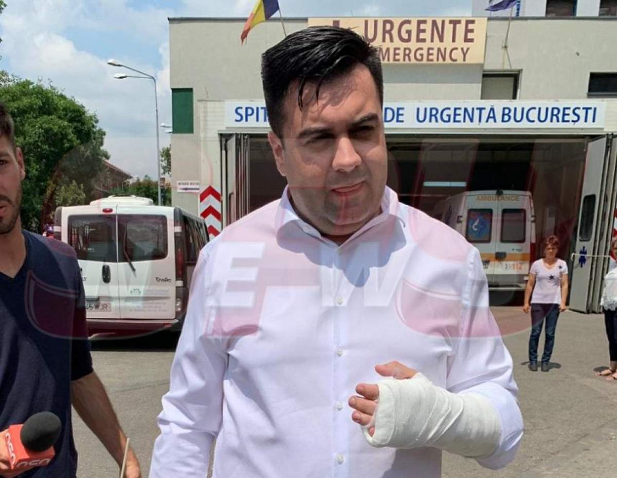Primele imagini cu ministrul Răzvan Cuc, după accident! S-a ales cu mâna în ghips