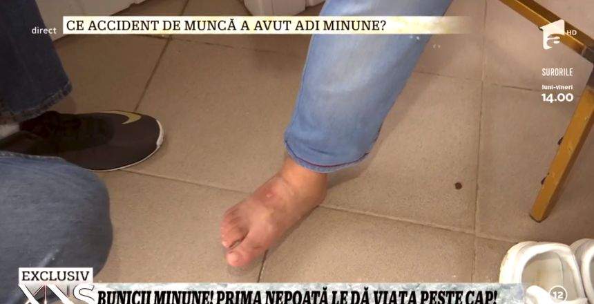 Adrian Minune s-a accidentat în timpul unei cântări. "Am păţit asta de la muncă"