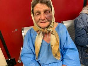 Bătrână bătută fără milă și jefuită, la Iași. Trei tâlhari au tăbărât pe ea: „Mi-au luat plasa cu bucate”