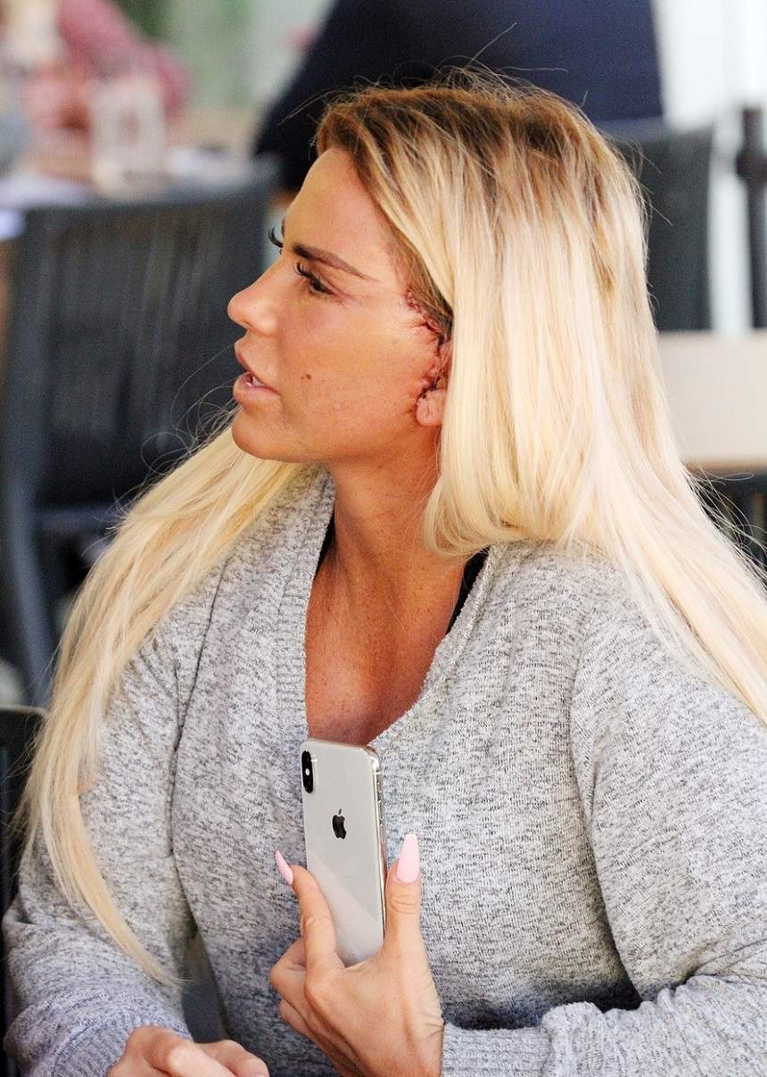 Katie Price, mutilată de intervențiile estetice! Actrița și-a deformat fața cu ultima operație și e de nerecunoscut