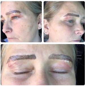 Cosmeticiana i-a distrus fața! O femeie și-a tatuat sprâncenele, dar a ieșit un dezastru / FOTO
