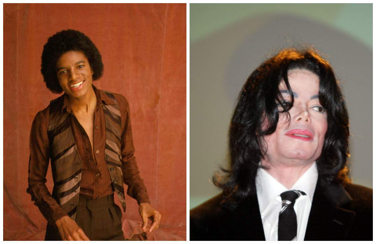 Adevărul despre operațiile lui Michael Jackson. Câte intervenții a avut, de fapt