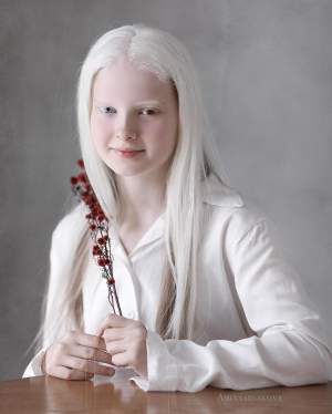 Ea este Amina, fetița cu albinism de o frumuseţe răpitoare! Imagini incredibile cu copila de doar 11 ani / FOTO 