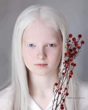 Ea este Amina, fetița cu albinism de o frumuseţe răpitoare! Imagini incredibile cu copila de doar 11 ani / FOTO 